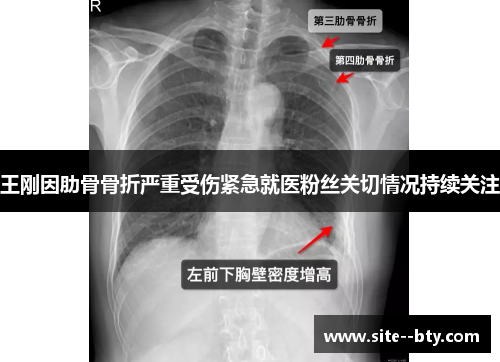 王刚因肋骨骨折严重受伤紧急就医粉丝关切情况持续关注 王刚因肋骨骨折严重受伤紧急就医粉丝关切情况持续关注